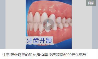 信息流广告